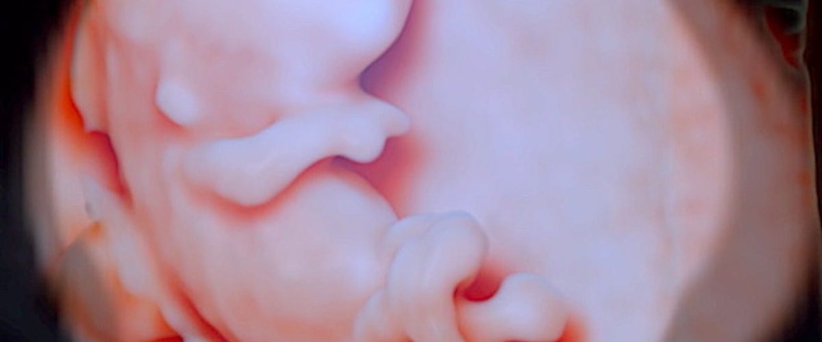 Ecocardiografía Embrionaria o de Viabilidad del embarazo Medicina Fetal Perú